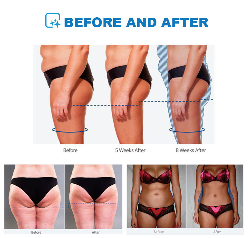 Electromagnetic 4 Handles emsl - огляд і ціна Ems Body Sculpting Machine Emslim