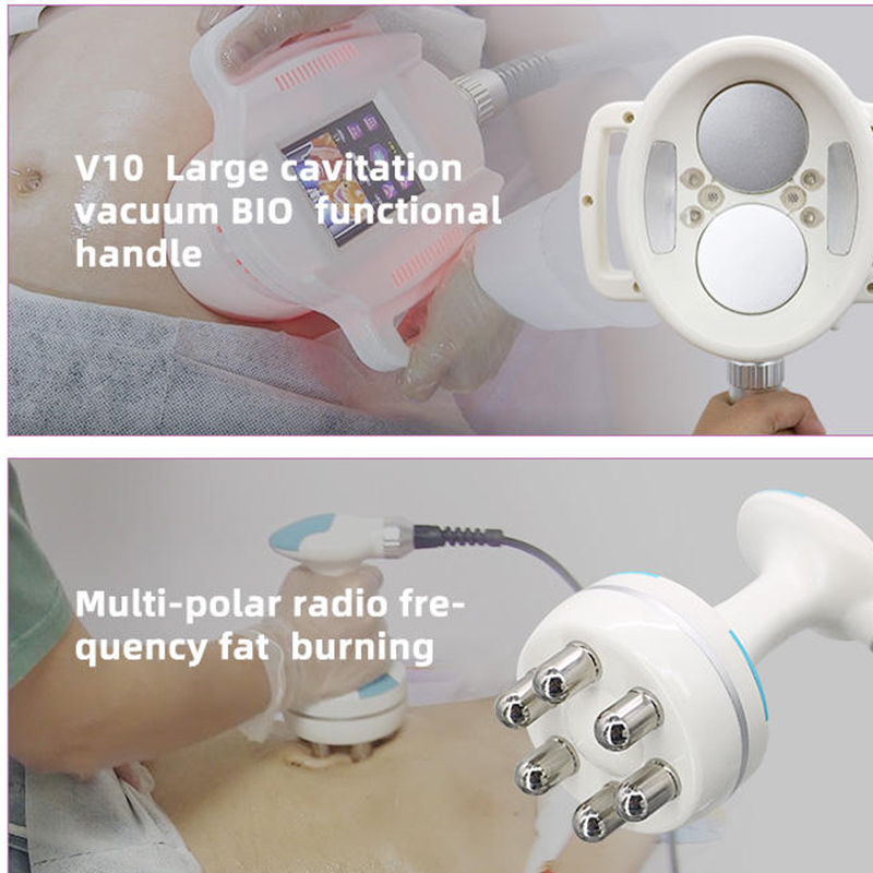 New Professional V-TEM Body Co - огляд і ціна Vacuum Cavitation Body Contouring